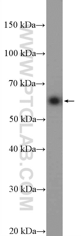 Western Blot (WB) analysis of HepG2 cells using ARFGAP2 Polyclonal antibody (16519-1-AP)