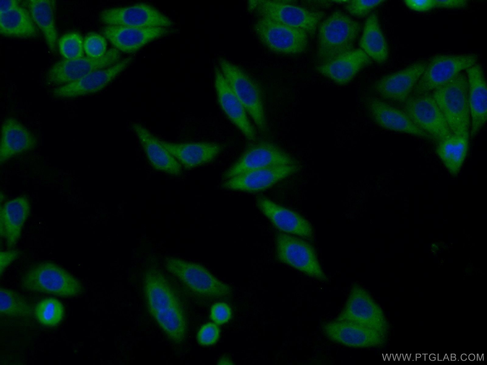 Immunofluorescence (IF) / fluorescent staining of HepG2 cells using ARFGAP3 Polyclonal antibody (15293-1-AP)