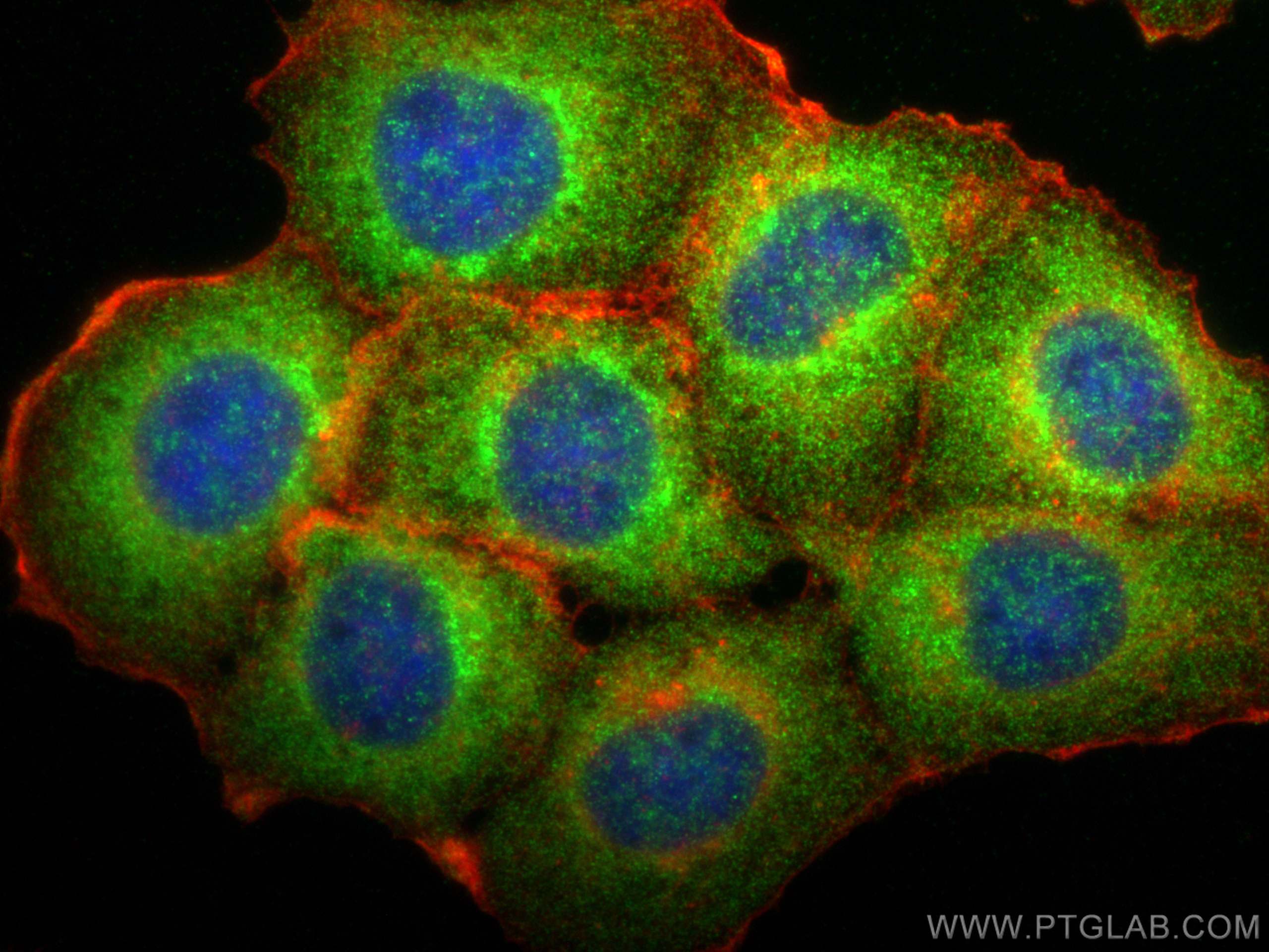 Immunofluorescence (IF) / fluorescent staining of A431 cells using ARFGAP3 Polyclonal antibody (15293-1-AP)