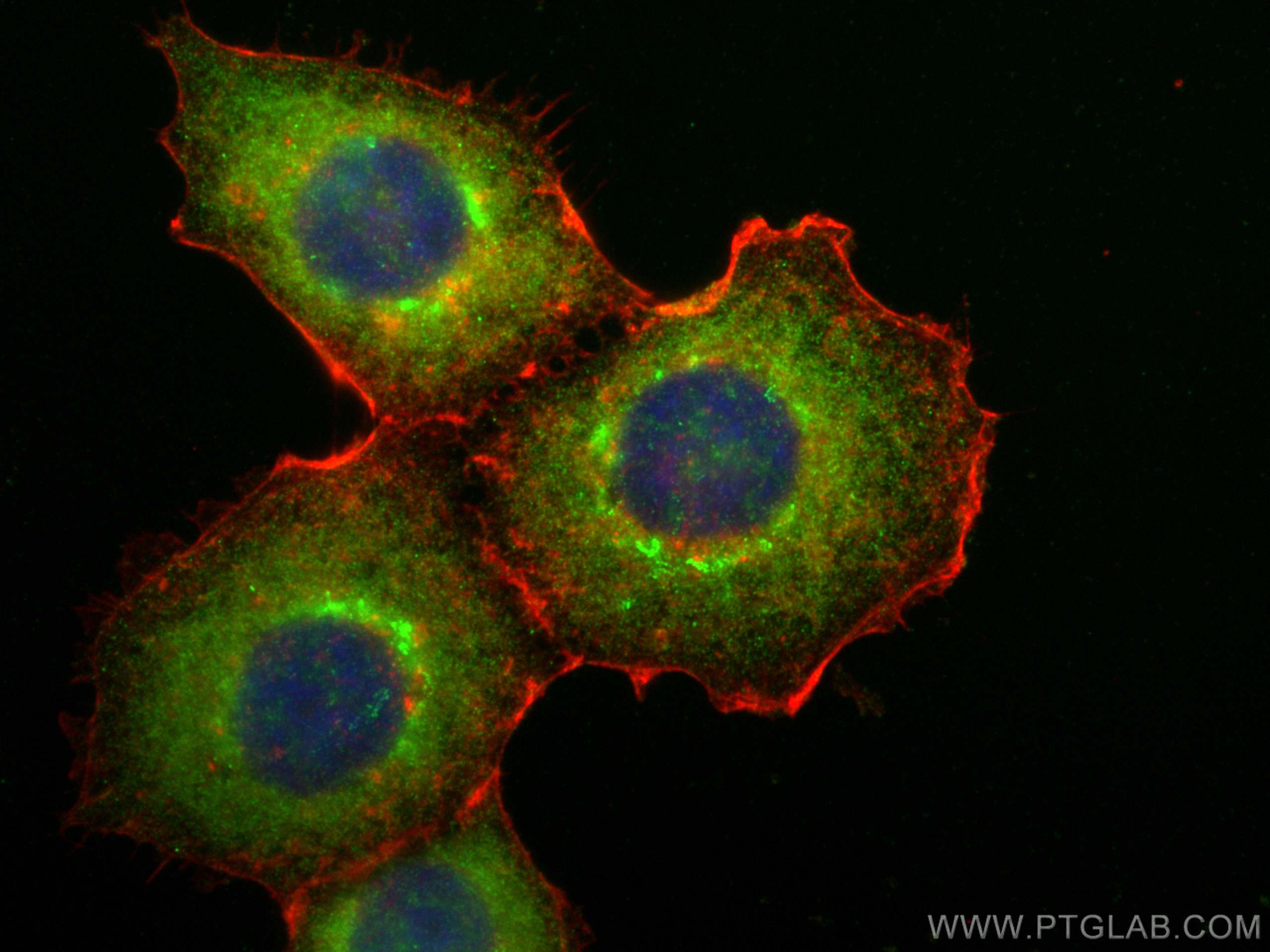 Immunofluorescence (IF) / fluorescent staining of A431 cells using ARFGAP3 Polyclonal antibody (15293-1-AP)