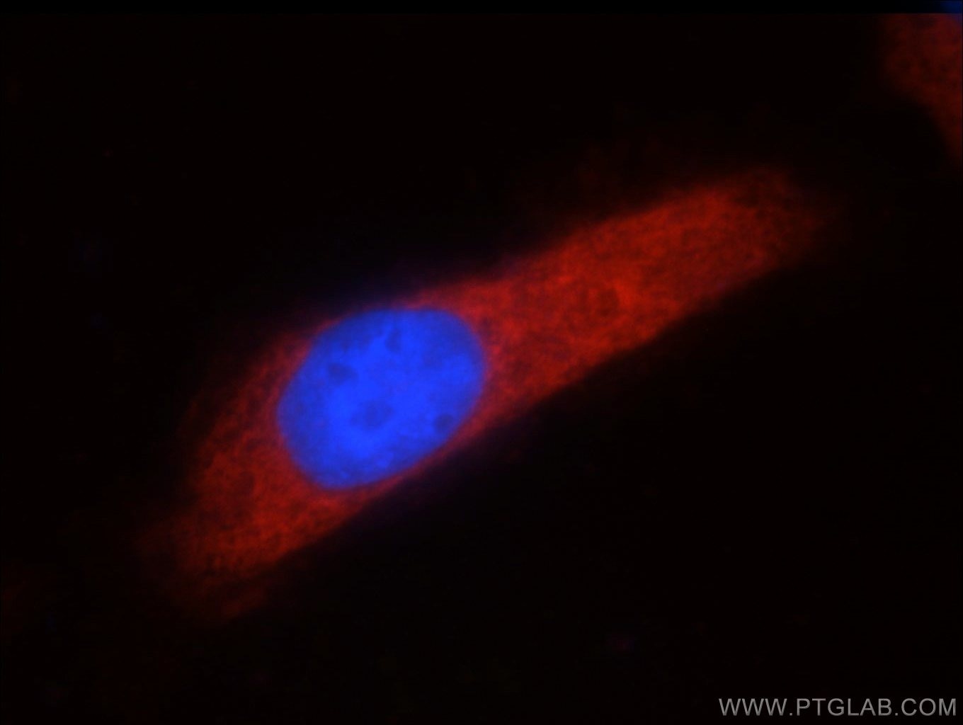 Immunofluorescence (IF) / fluorescent staining of A431 cells using ARFGAP3 Polyclonal antibody (15293-1-AP)