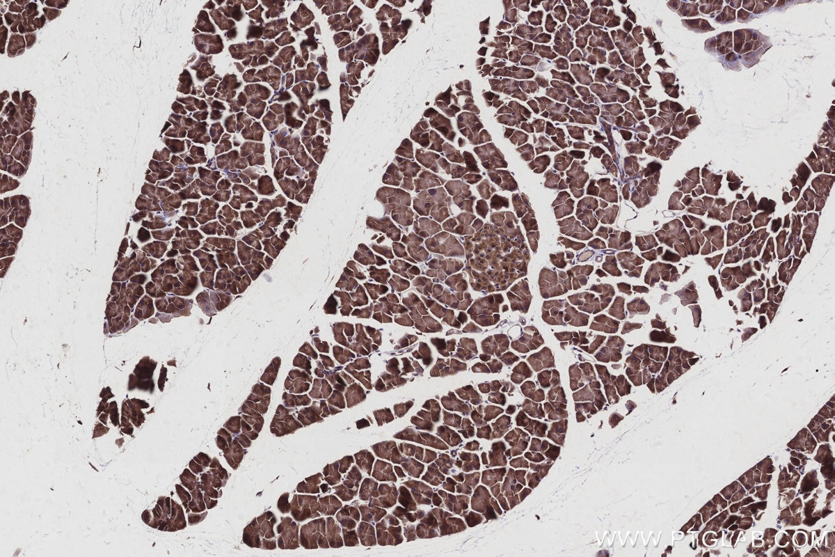 Immunohistochemistry (IHC) staining of mouse pancreas tissue using ARFGAP3 Polyclonal antibody (15293-1-AP)