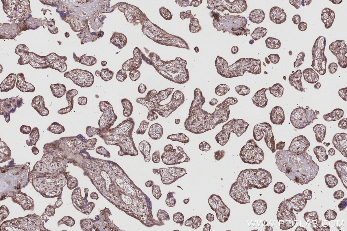 Immunohistochemistry (IHC) staining of human placenta tissue using ARFGAP3 Polyclonal antibody (15293-1-AP)