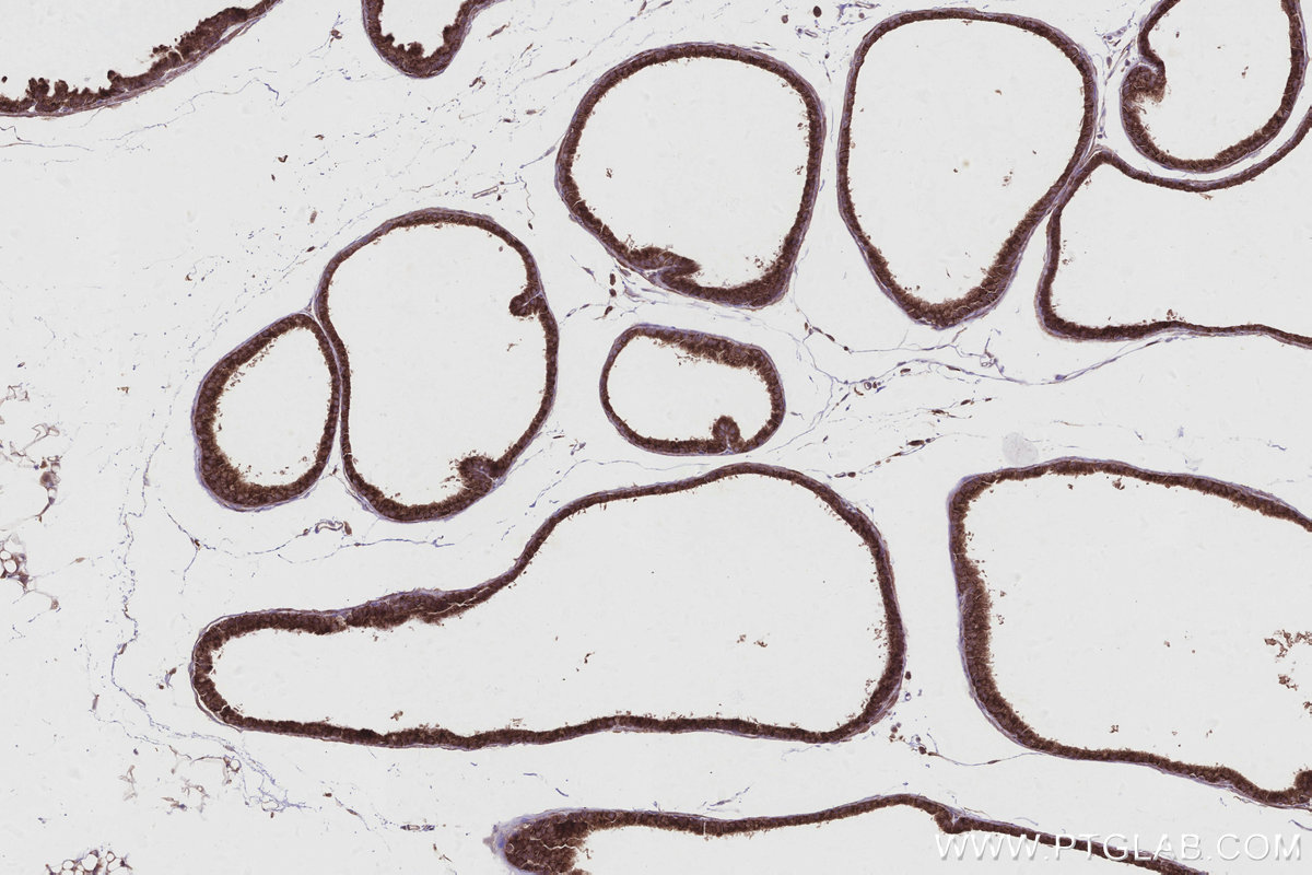 Immunohistochemistry (IHC) staining of mouse prostate tissue using ARFGAP3 Polyclonal antibody (15293-1-AP)