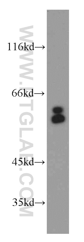 Western Blot (WB) analysis of HepG2 cells using ARFGAP3 Polyclonal antibody (15293-1-AP)