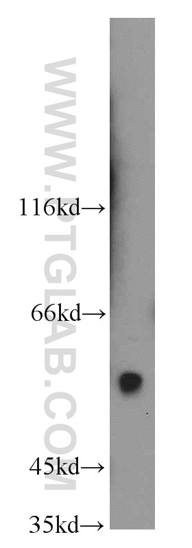 Western Blot (WB) analysis of mouse brain tissue using ARFGAP3 Polyclonal antibody (15293-1-AP)