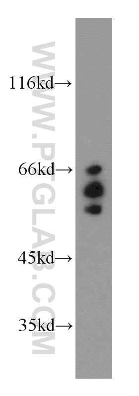 Western Blot (WB) analysis of Jurkat cells using ARFGAP3 Polyclonal antibody (15293-1-AP)