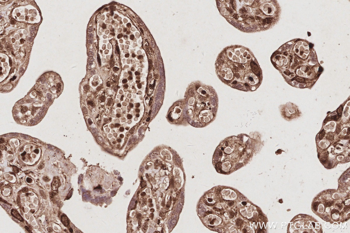 IHC staining of human placenta using 31684-1-AP Immunohistochemistry (IHC) staining of human placenta tissue using ARFGEF1 Polyclonal antibody (31684-1-AP)