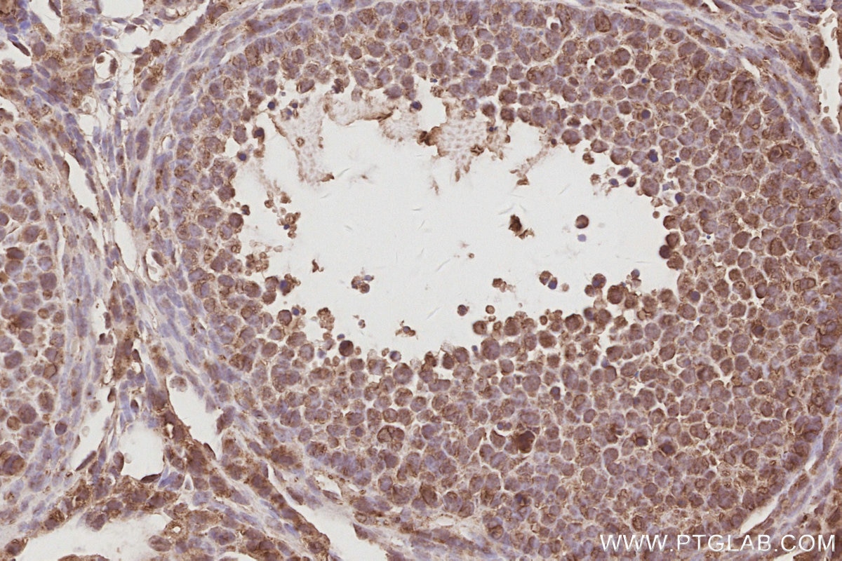 IHC staining of mouse ovary using 31684-1-AP Immunohistochemistry (IHC) staining of mouse ovary tissue using ARFGEF1 Polyclonal antibody (31684-1-AP)