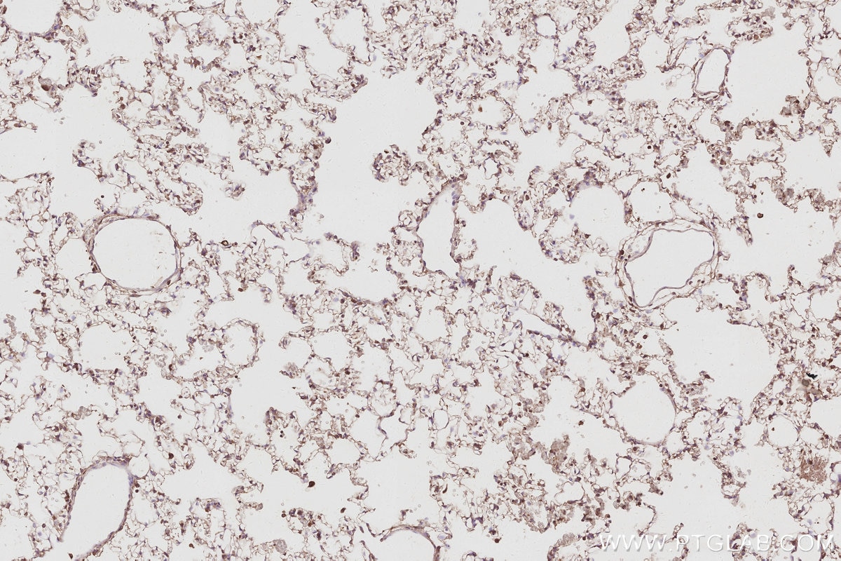 IHC staining of rat lung using 31684-1-AP Immunohistochemistry (IHC) staining of rat lung tissue using ARFGEF1 Polyclonal antibody (31684-1-AP)