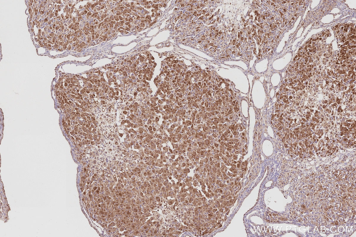 IHC staining of rat ovary using 31684-1-AP Immunohistochemistry (IHC) staining of rat ovary tissue using ARFGEF1 Polyclonal antibody (31684-1-AP)