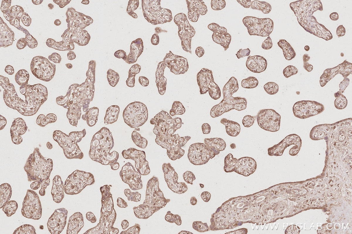 IHC staining of human placenta using 31277-1-AP Immunohistochemistry (IHC) staining of human placenta tissue using ARFGEF2 Polyclonal antibody (31277-1-AP)