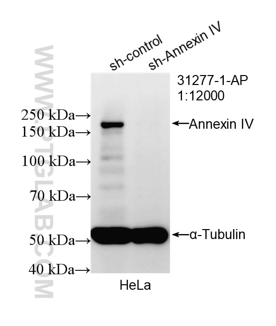 WB analysis of HepG2 using 31277-1-AP (same clone as 31277-1-PBS) Western Blot (WB) analysis of HepG2 cells using ARFGEF2 Polyclonal antibody (31277-1-AP)