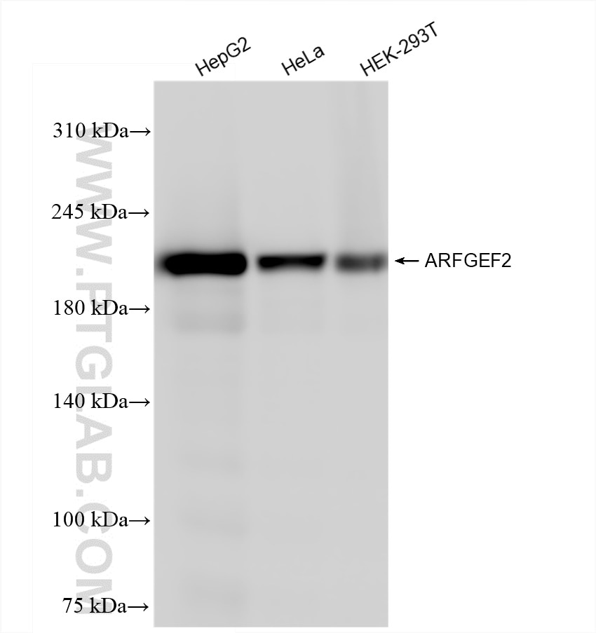 Western Blot (WB) analysis of various lysates using ARFGEF2 Recombinant antibody (84296-4-RR)