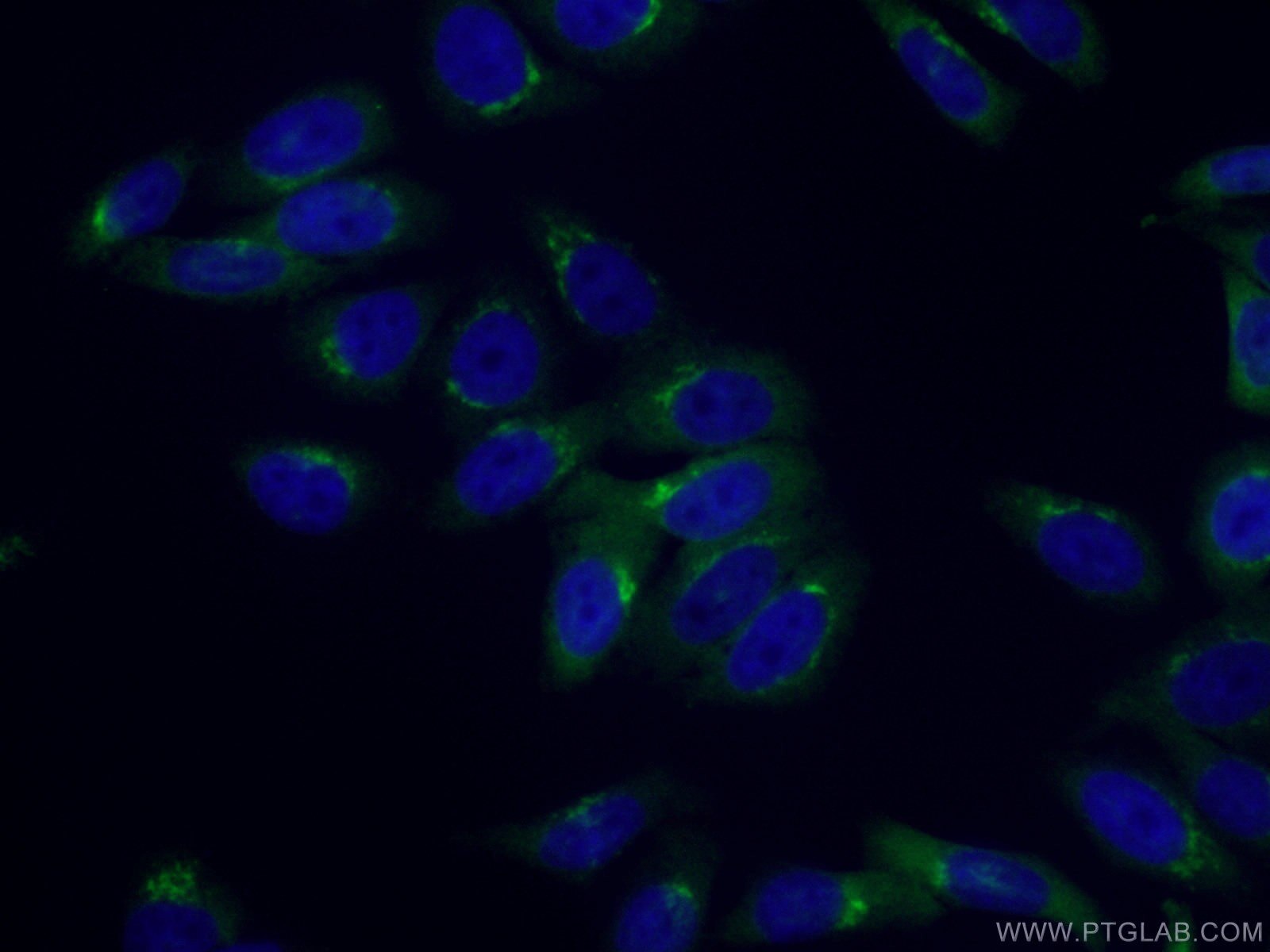 Immunofluorescence (IF) / fluorescent staining of HepG2 cells using Arfaptin-1 Polyclonal antibody (17726-1-AP)