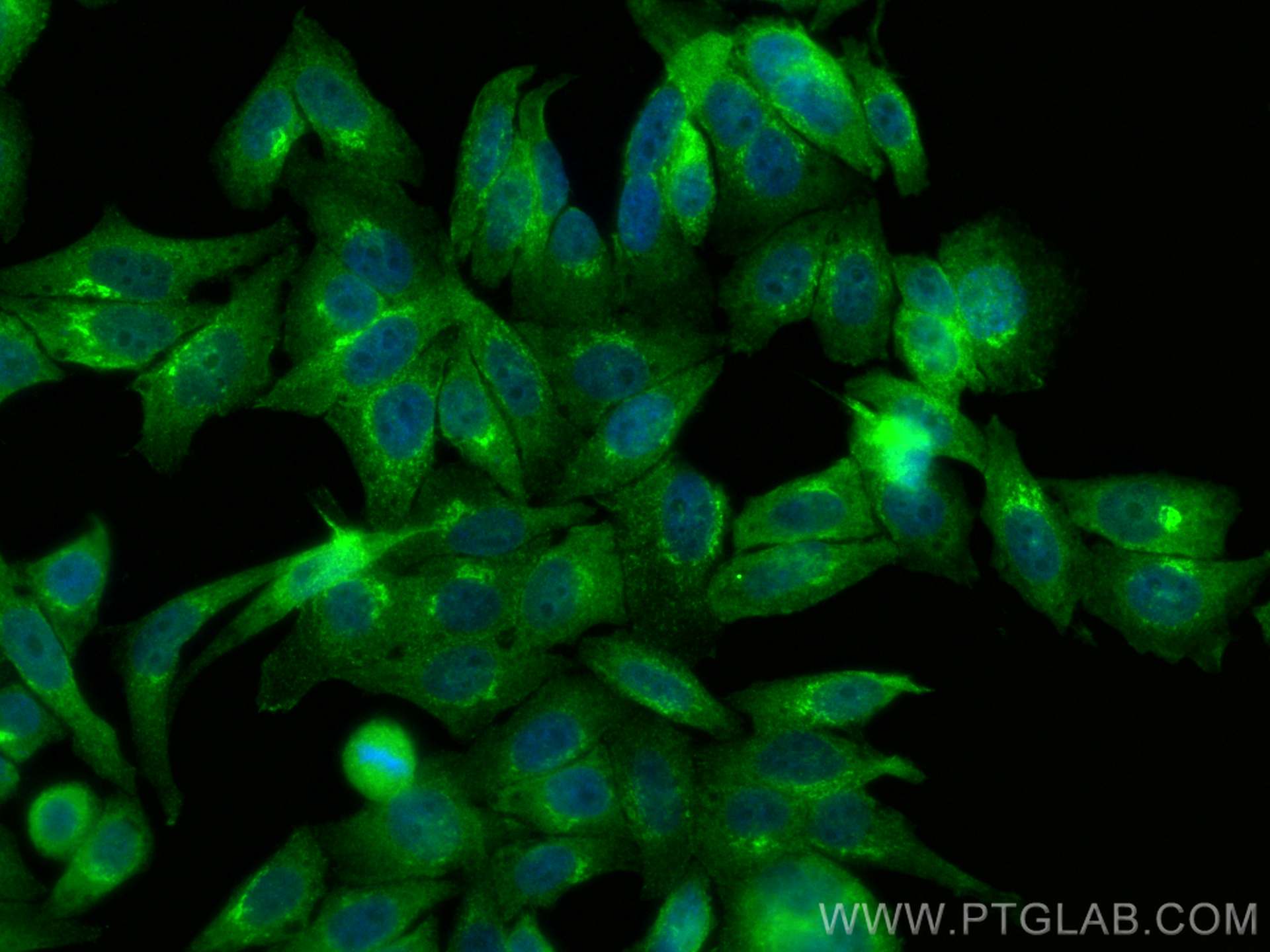 Immunofluorescence (IF) / fluorescent staining of HepG2 cells using Arfaptin-1 Polyclonal antibody (17726-1-AP)