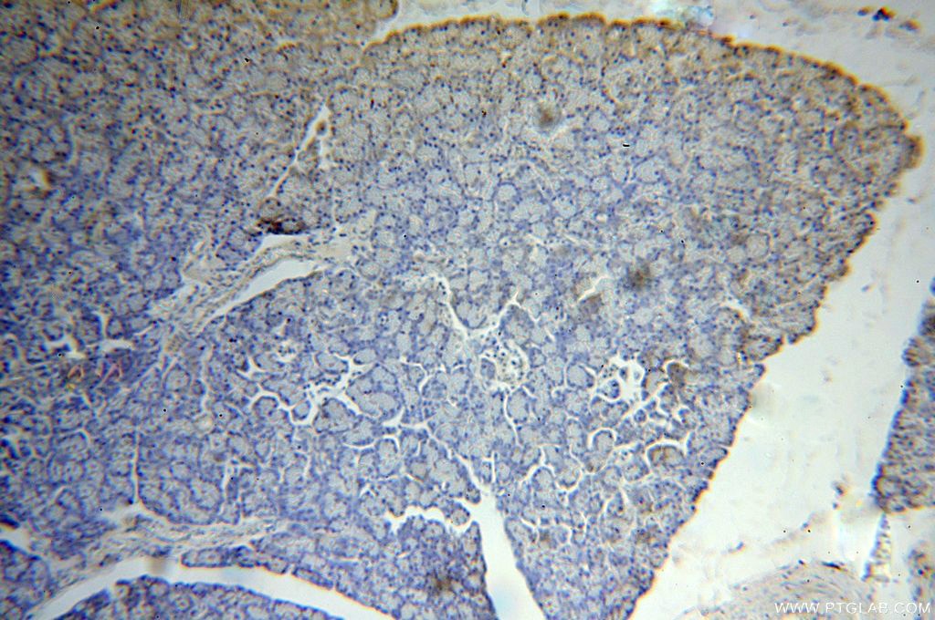 Immunohistochemistry (IHC) staining of human pancreas tissue using Arfaptin-1 Polyclonal antibody (17726-1-AP)