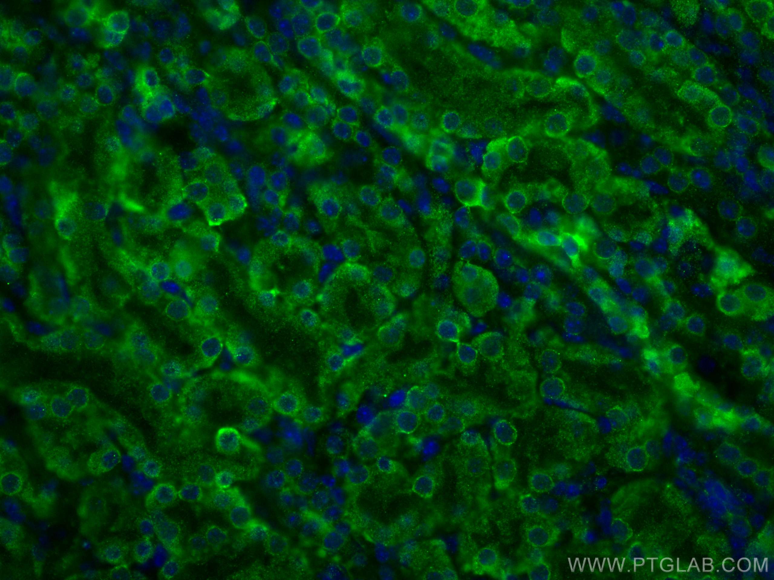 Immunofluorescence (IF) / fluorescent staining of mouse kidney tissue using Arfaptin-1 Monoclonal antibody (67461-1-Ig)