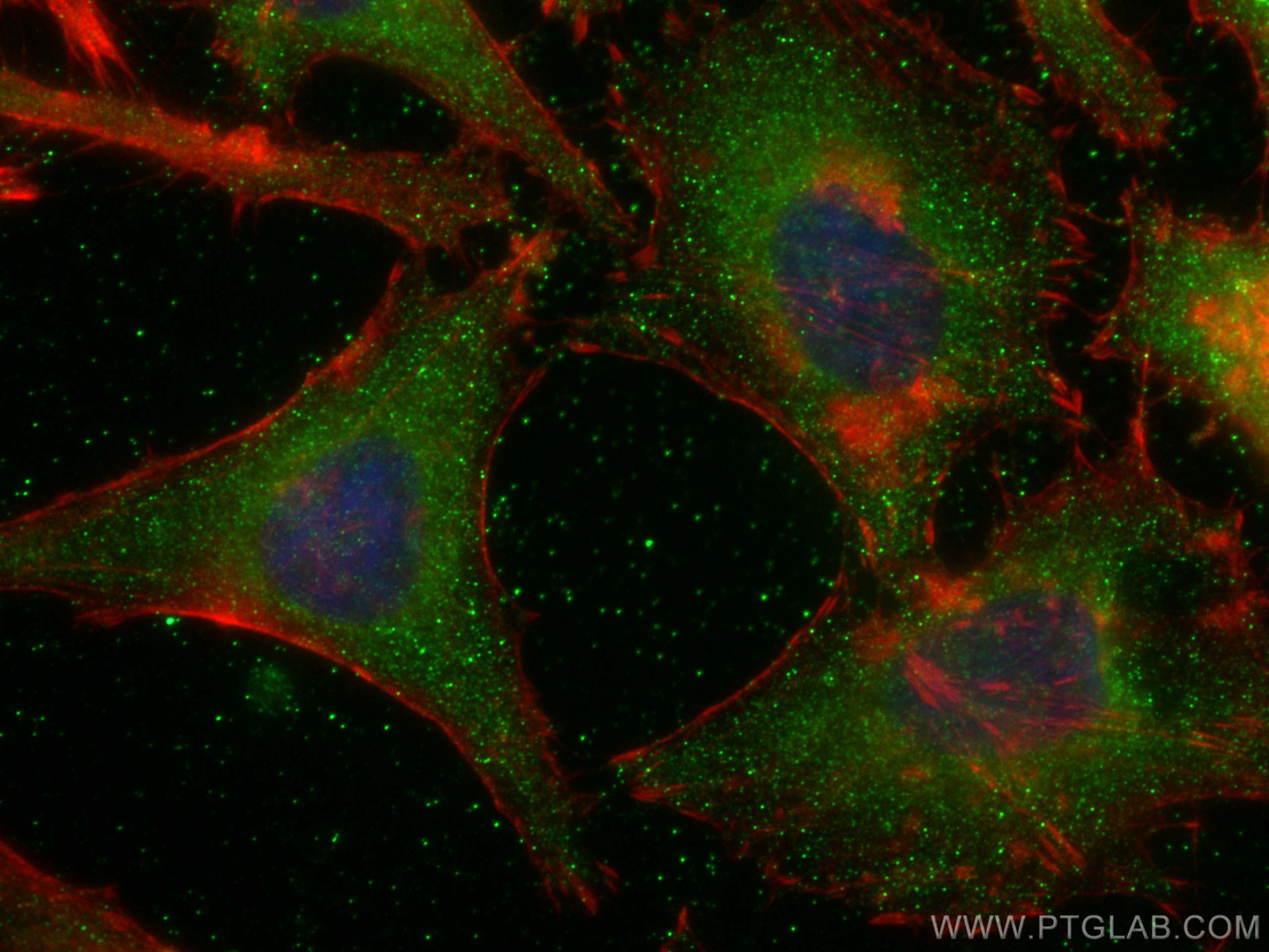 Immunofluorescence (IF) / fluorescent staining of HeLa cells using Arfaptin-1 Monoclonal antibody (67461-1-Ig)