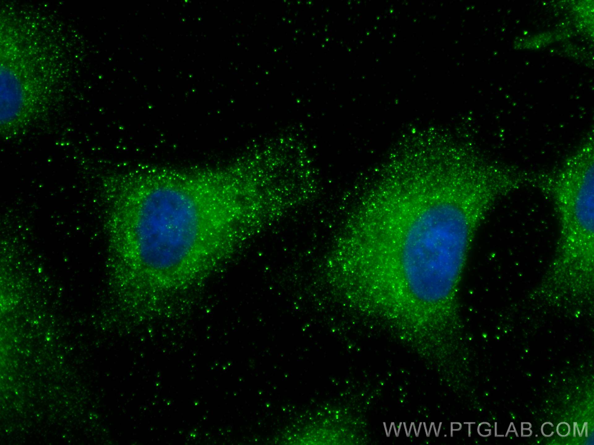 Immunofluorescence (IF) / fluorescent staining of A549 cells using Arfaptin-1 Monoclonal antibody (67461-1-Ig)