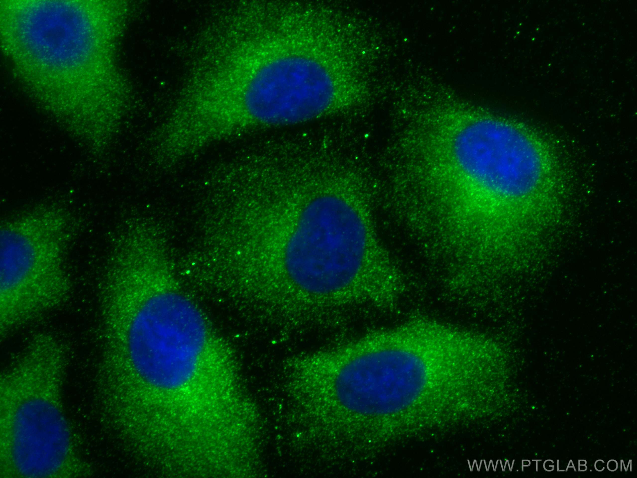 Immunofluorescence (IF) / fluorescent staining of A549 cells using Arfaptin-1 Monoclonal antibody (67461-1-Ig)