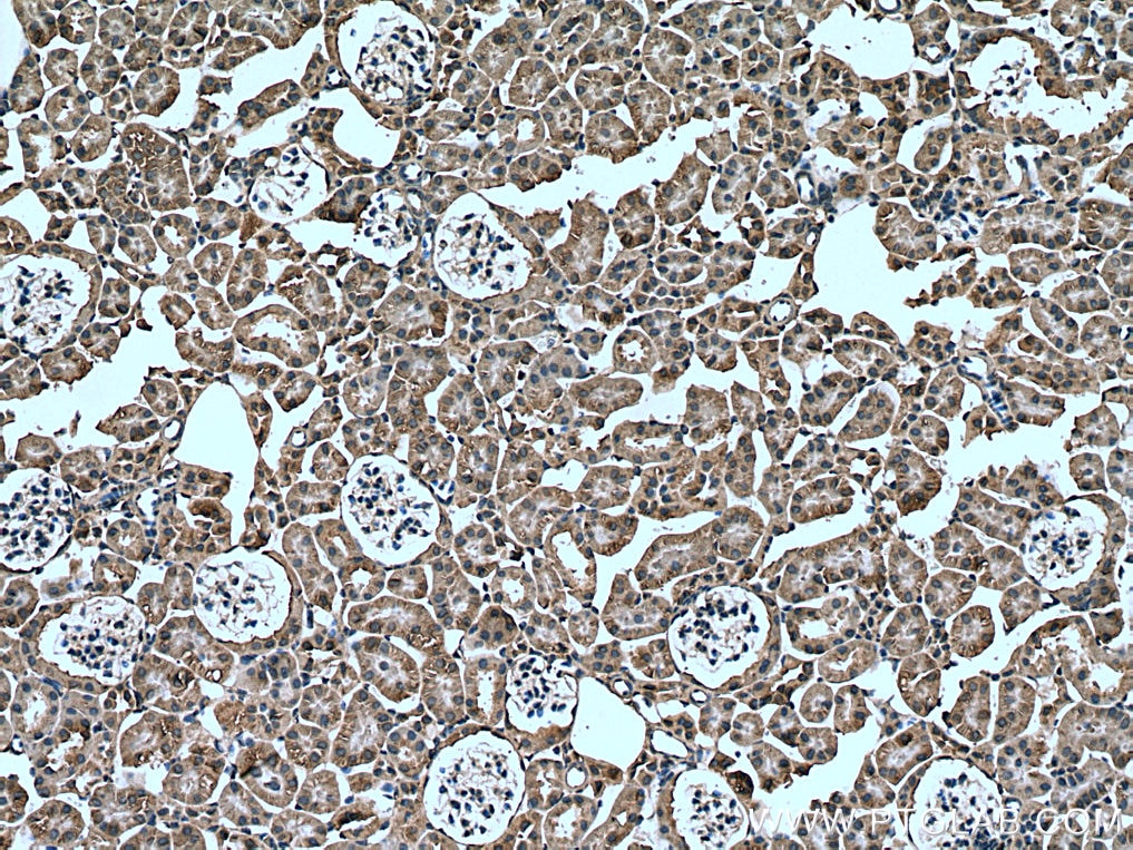 Immunohistochemistry (IHC) staining of mouse kidney tissue using Arfaptin-1 Monoclonal antibody (67461-1-Ig)