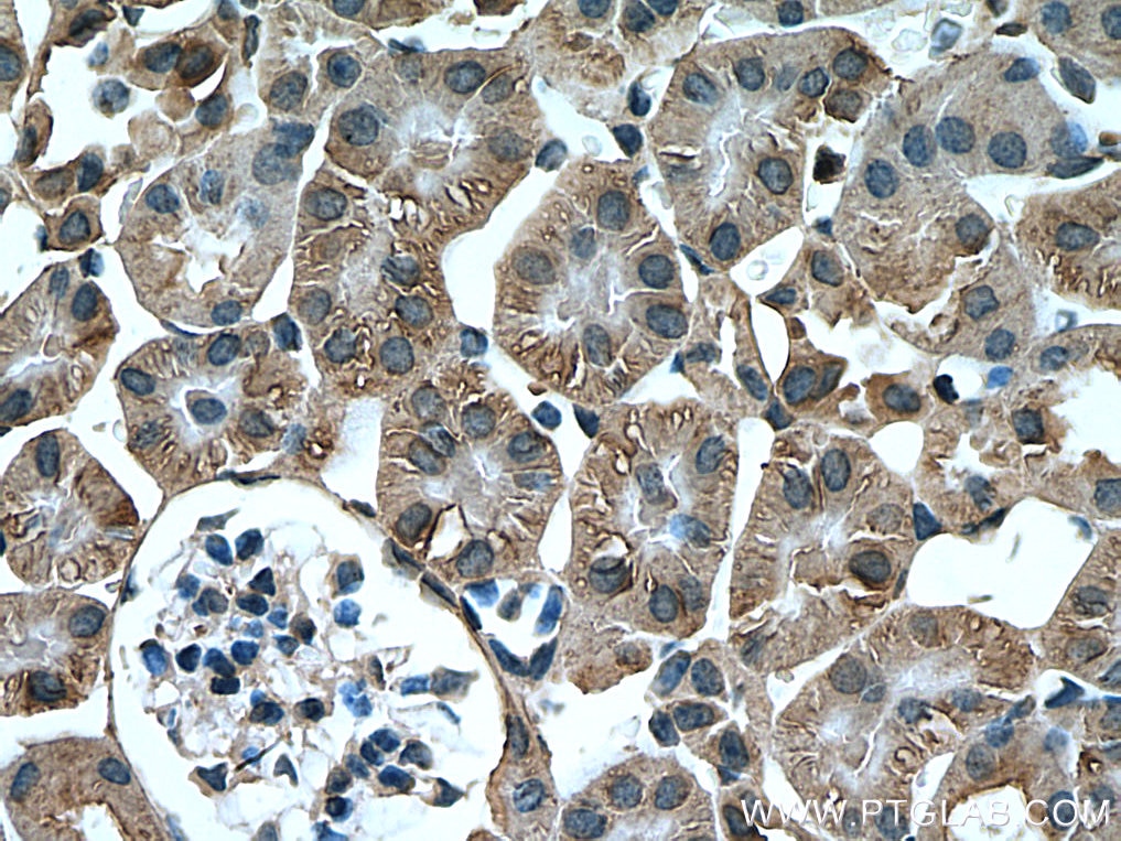 Immunohistochemistry (IHC) staining of mouse kidney tissue using Arfaptin-1 Monoclonal antibody (67461-1-Ig)