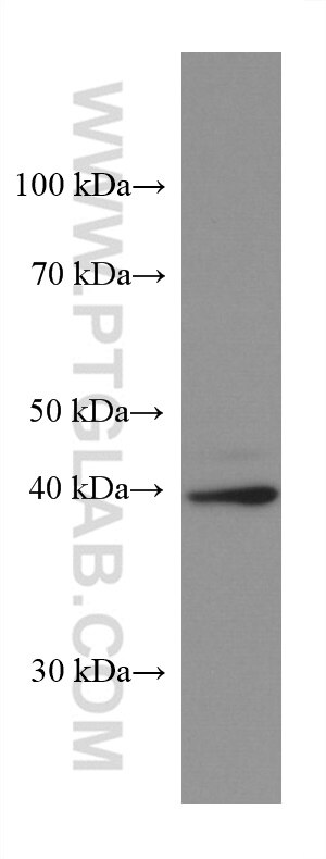 Western Blot (WB) analysis of 4T1 cells using Arfaptin-1 Monoclonal antibody (67461-1-Ig)