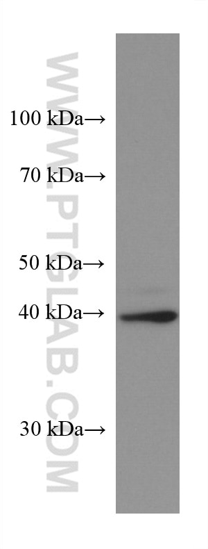 WB analysis of 4T1 using 67461-1-Ig