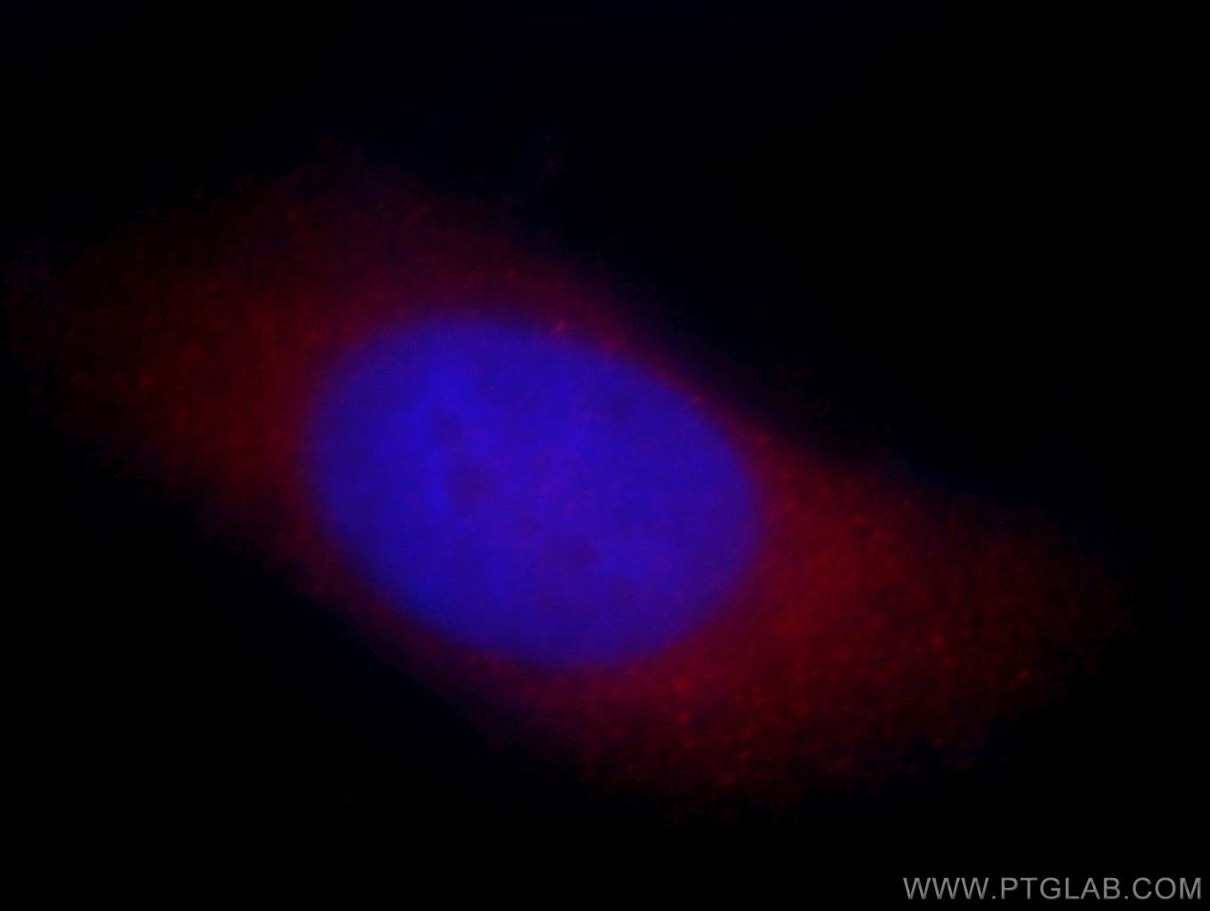 Immunofluorescence (IF) / fluorescent staining of HeLa cells using ARFIP2 Polyclonal antibody (14548-1-AP)