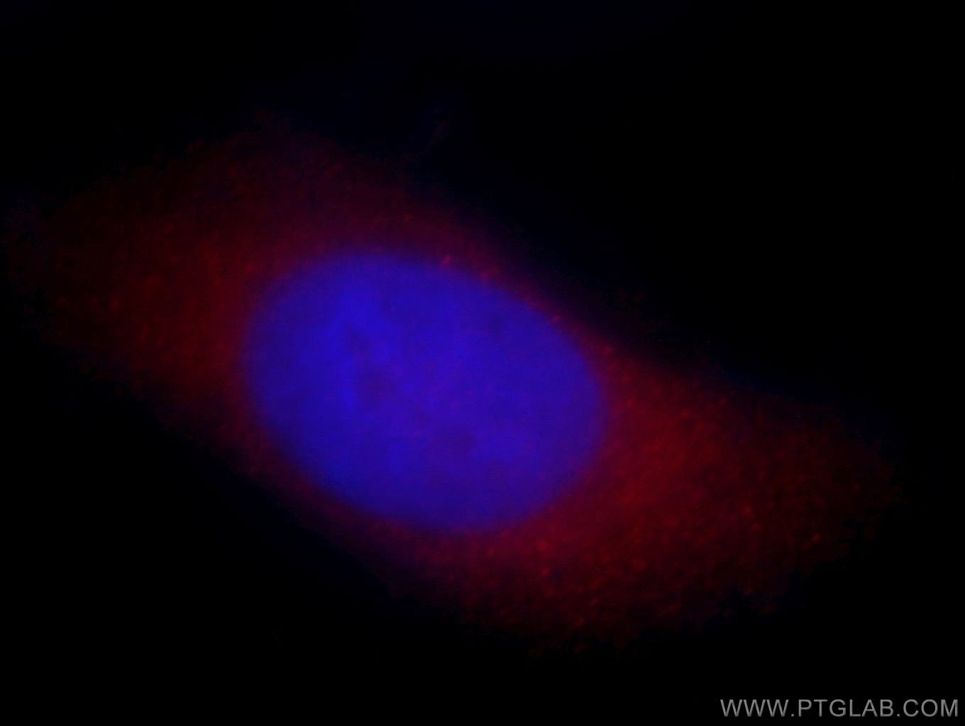 IF Staining of HeLa using 14548-1-AP