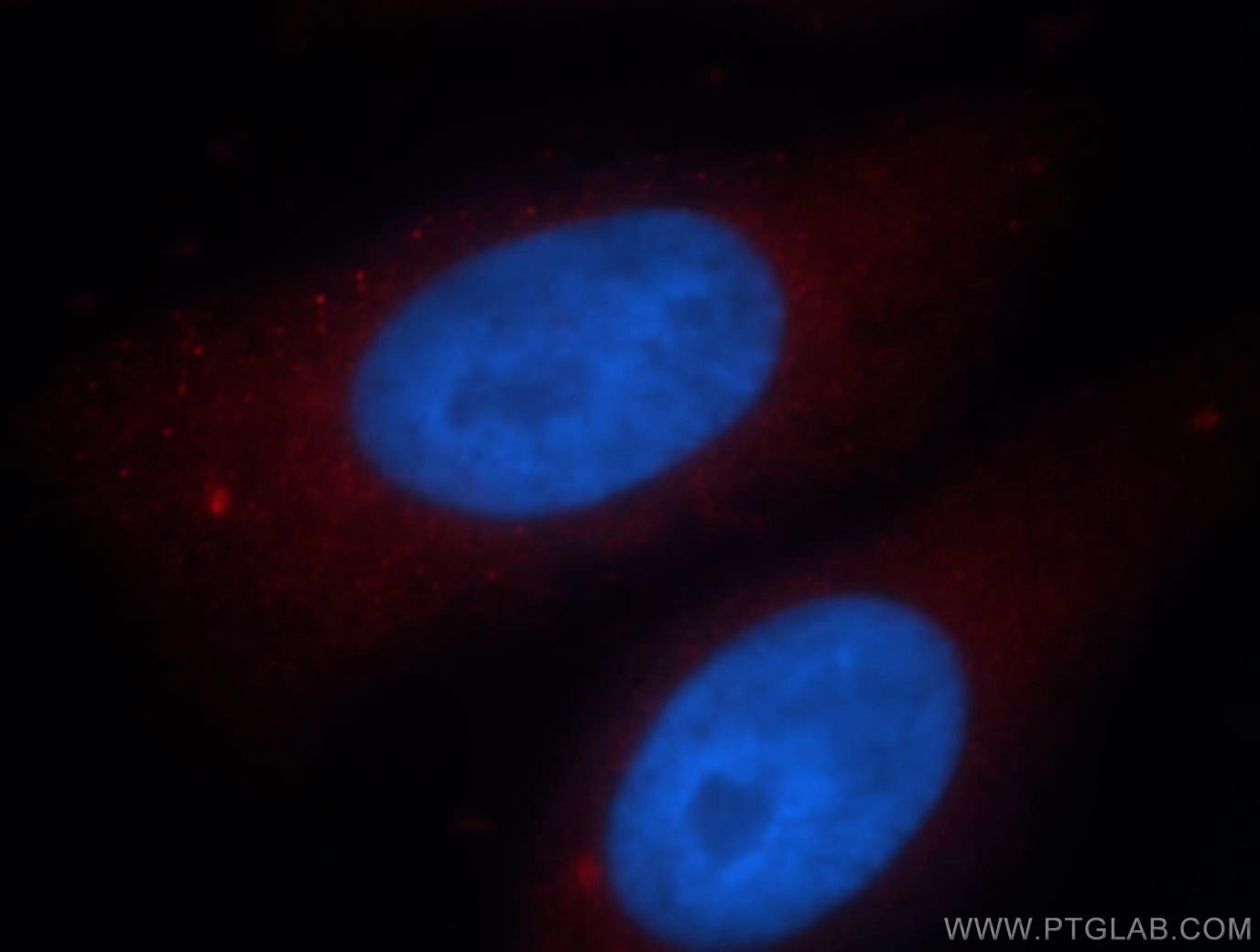 Immunofluorescence (IF) / fluorescent staining of HepG2 cells using ARFIP2 Polyclonal antibody (14548-1-AP)