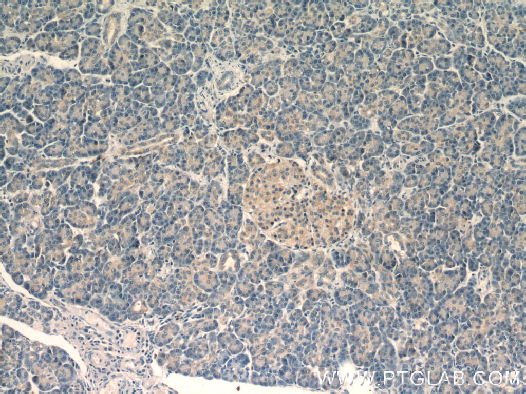 Immunohistochemistry (IHC) staining of human pancreas tissue using ARFIP2 Polyclonal antibody (14548-1-AP)
