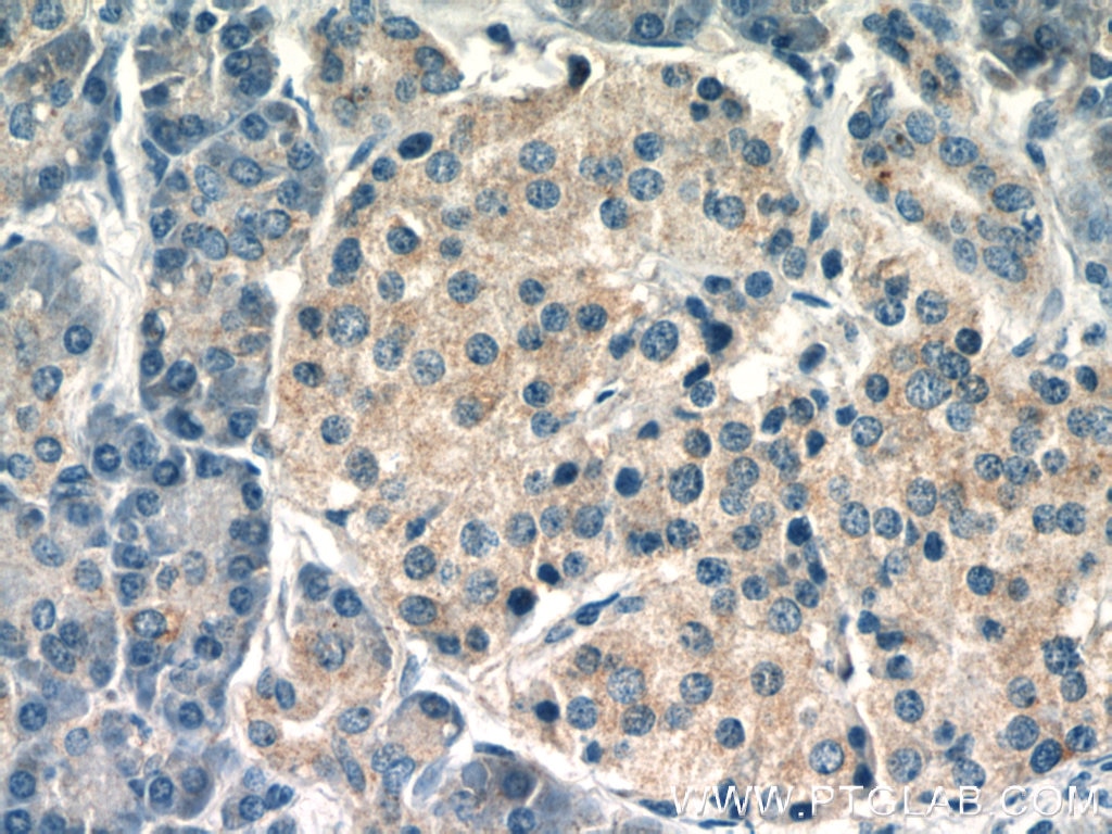 Immunohistochemistry (IHC) staining of human pancreas tissue using ARFIP2 Polyclonal antibody (14548-1-AP)