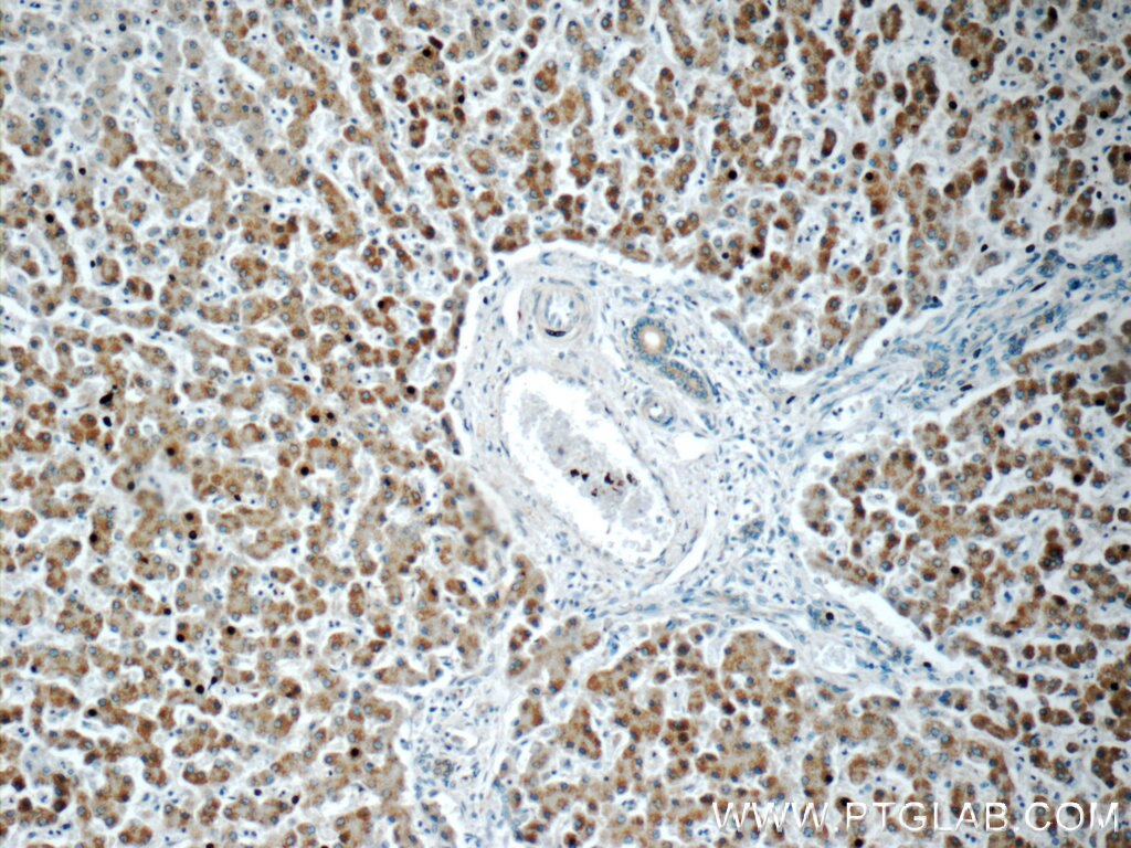 Immunohistochemistry (IHC) staining of human liver tissue using ARFIP2 Polyclonal antibody (14548-1-AP)