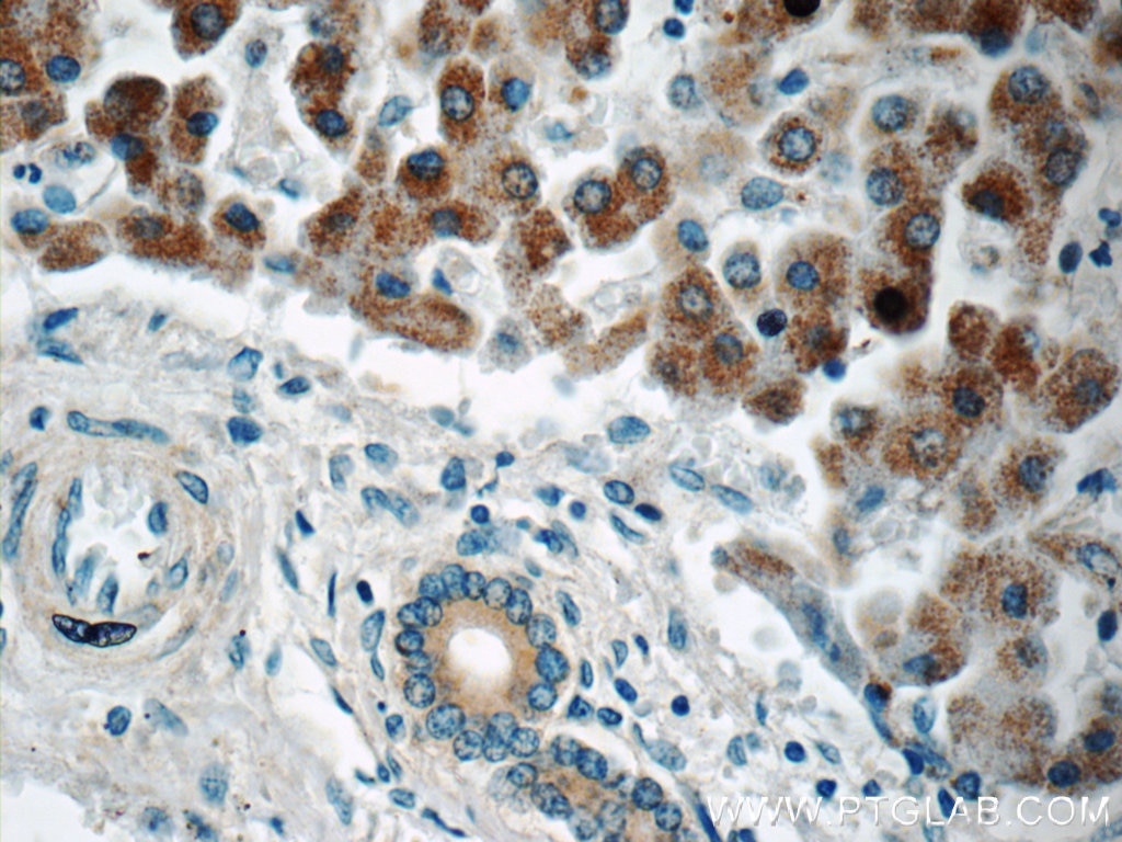 Immunohistochemistry (IHC) staining of human liver tissue using ARFIP2 Polyclonal antibody (14548-1-AP)