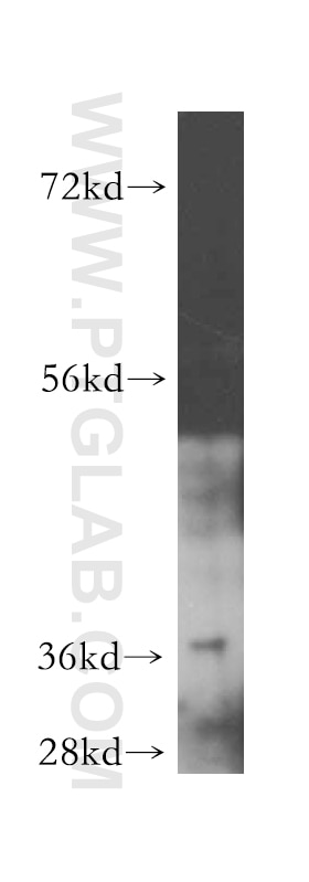 Western Blot (WB) analysis of human heart tissue using ARFIP2 Polyclonal antibody (14548-1-AP)