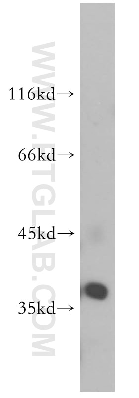 Western Blot (WB) analysis of HeLa cells using ARFIP2 Polyclonal antibody (14548-1-AP)