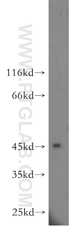 Western Blot (WB) analysis of human brain tissue using ARFIP2 Polyclonal antibody (14548-1-AP)