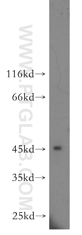 WB analysis of human brain using 14548-1-AP