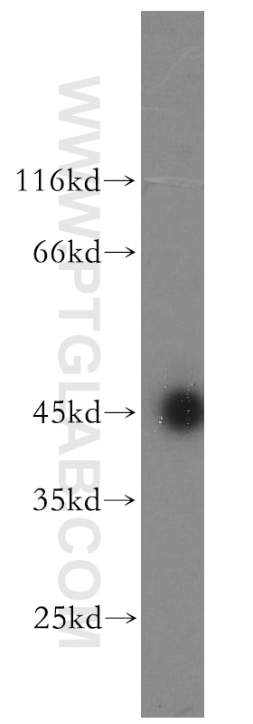 Western Blot (WB) analysis of HeLa cells using ARFIP2 Polyclonal antibody (14548-1-AP)