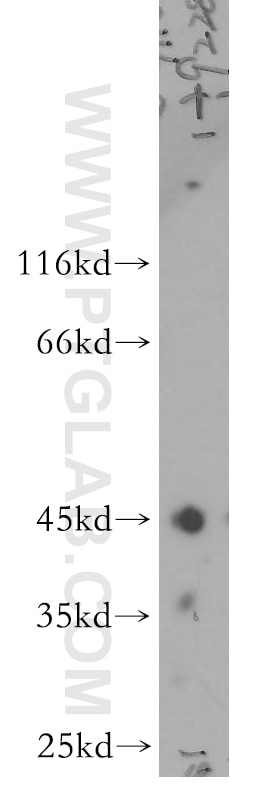 Western Blot (WB) analysis of mouse pancreas tissue using ARFIP2 Polyclonal antibody (14548-1-AP)