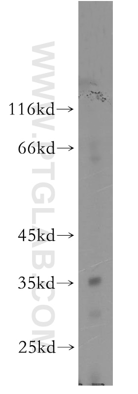 Western Blot (WB) analysis of human liver tissue using ARFIP2 Polyclonal antibody (14548-1-AP)