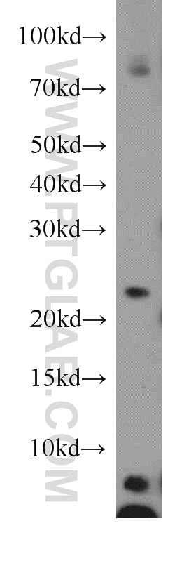 Western Blot (WB) analysis of Jurkat cells using ARFRP1 Polyclonal antibody (17712-1-AP)