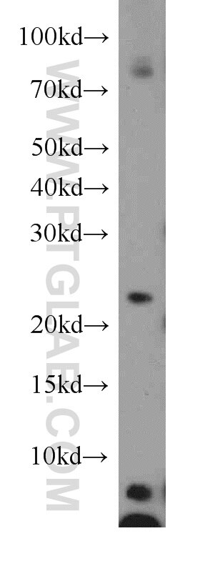 WB analysis of Jurkat using 17712-1-AP