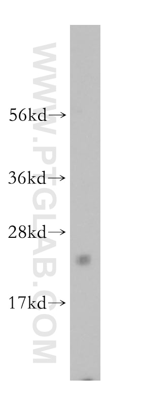 Western Blot (WB) analysis of Jurkat cells using ARFRP1 Polyclonal antibody (17712-1-AP)