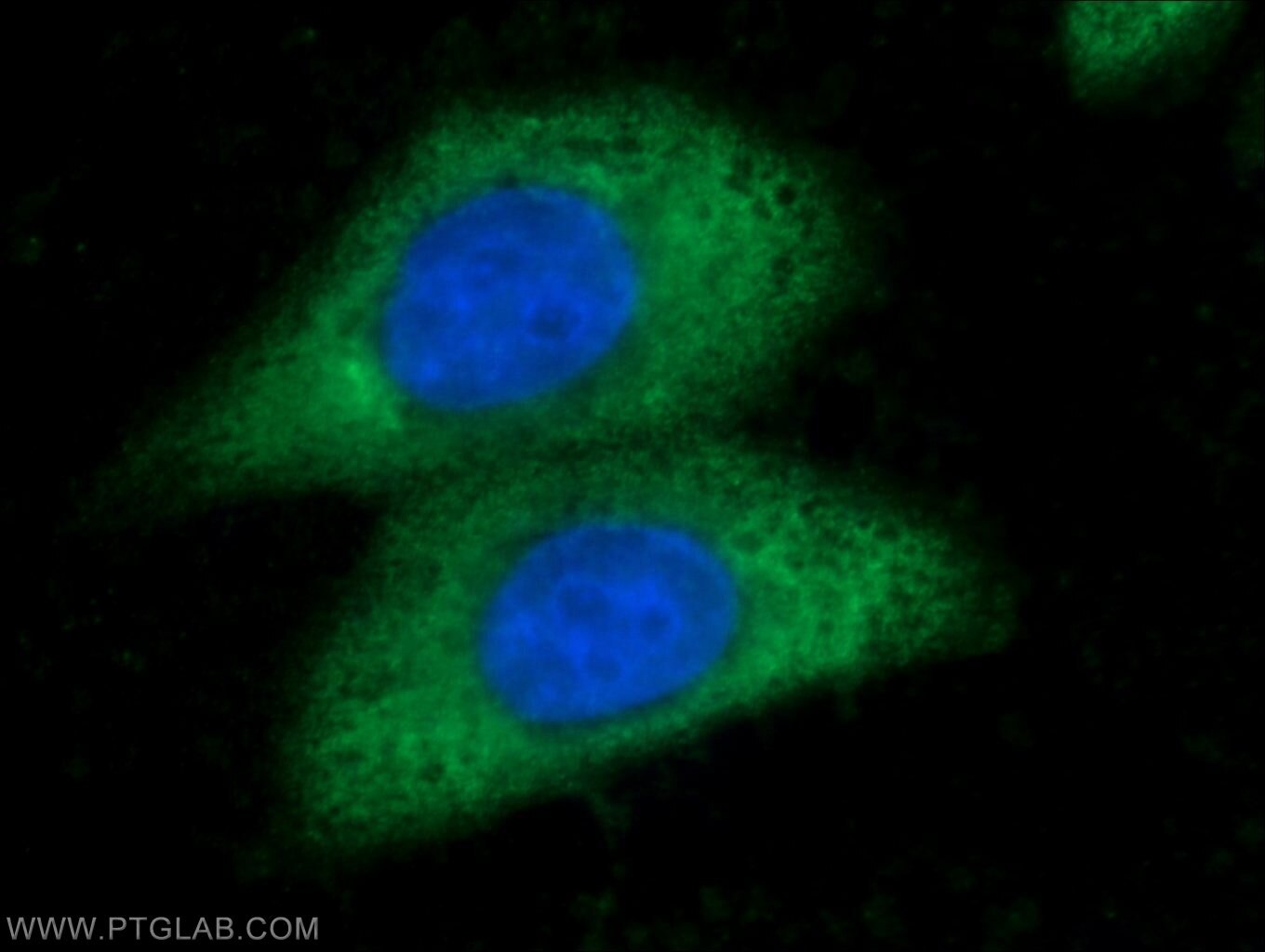 Arginase-1 Polyclonal antibody