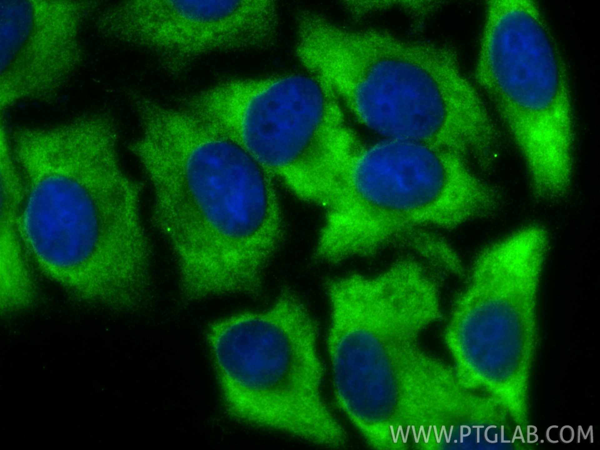 Immunofluorescence (IF) / fluorescent staining of HepG2 cells using Arginase-1 Polyclonal antibody (16001-1-AP)