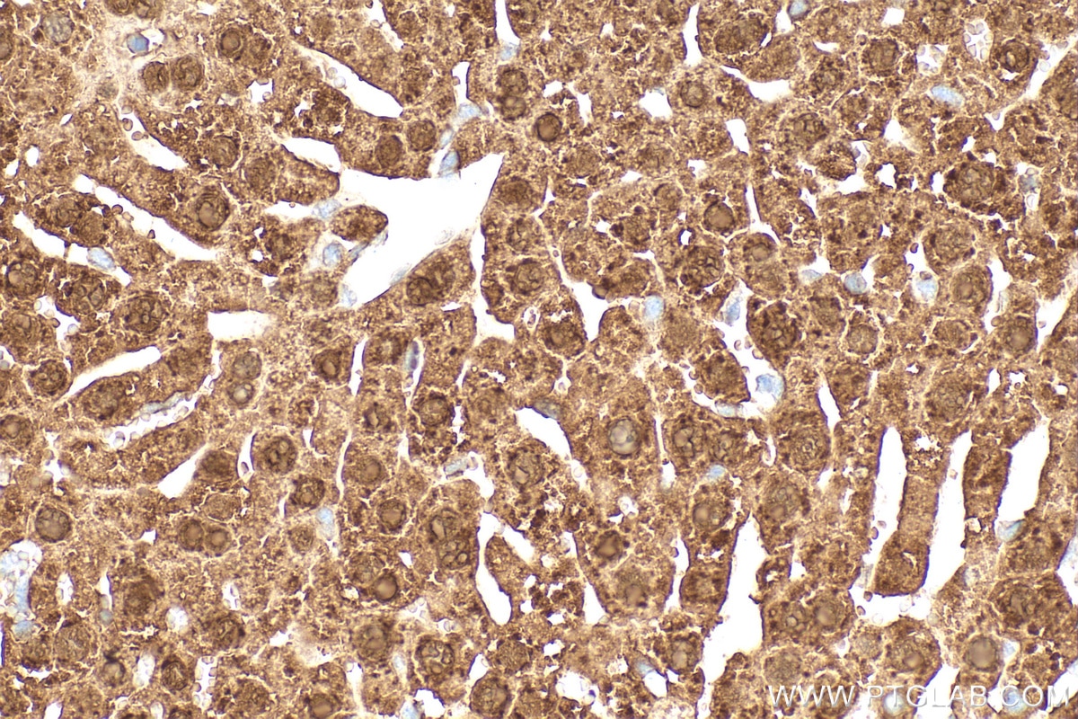 Immunohistochemistry (IHC) staining of mouse liver tissue using Arginase-1 Polyclonal antibody (16001-1-AP)