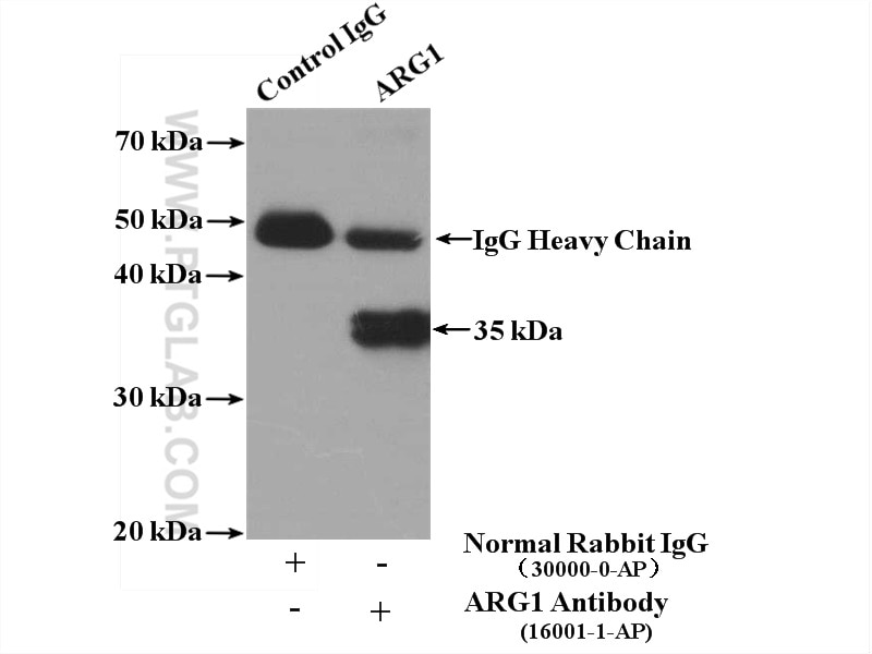Immunoprecipitation (IP) experiment of mouse liver tissue using Arginase-1 Polyclonal antibody (16001-1-AP)
